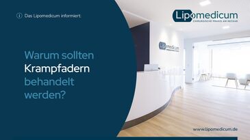 Warum sollten Krampfadern behandelt werden?