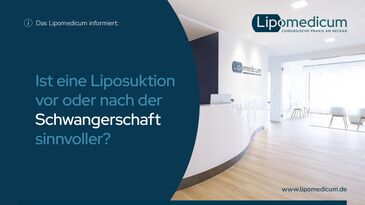 Liposuktion eher vor oder nach der Schwangerschaft?